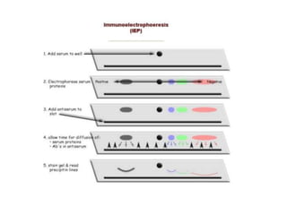 Radioimmunoassay