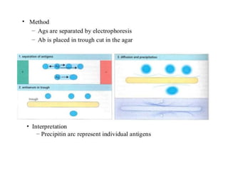 Radioimmunoassay