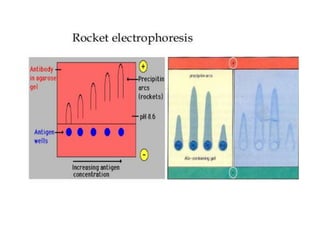 Radioimmunoassay