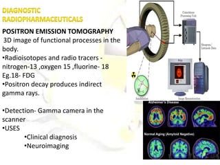 POSITRON EMISSION TOMOGRAPHY
3D image of functional processes in the
body.
•Radioisotopes and radio tracers -
nitrogen-13 ,oxygen 15 ,fluorine- 18
Eg.18- FDG
•Positron decay produces indirect
gamma rays.
•Detection- Gamma camera in the
scanner
•USES
•Clinical diagnosis
•Neuroimaging
 