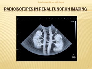 RADIOISOTOPES IN RENAL FUNCTION IMAGING
14
Dept of Urology, GRH and KMC, Chennai.
 