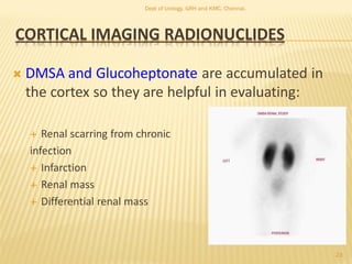 CORTICAL IMAGING RADIONUCLIDES
 DMSA and Glucoheptonate are accumulated in
the cortex so they are helpful in evaluating:
 Renal scarring from chronic
infection
 Infarction
 Renal mass
 Differential renal mass
23
Dept of Urology, GRH and KMC, Chennai.
 