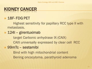 KIDNEY CANCER
 18F- FDG PET
Highest sensitivity for papillary RCC type II with
metastasis.
 124I – girentuximab
target Carbonic anhydrase IX (CAIX)
CAIX universally expressed by clear cell RCC
 99mTc – sestamibi
Bind with high mitochondrial content
Bening oncocytoma, parathyroid adenoma
33
Dept of Urology, GRH and KMC, Chennai.
 