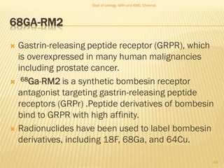 68GA-RM2
 Gastrin-releasing peptide receptor (GRPR), which
is overexpressed in many human malignancies
including prostate cancer.
 68Ga-RM2 is a synthetic bombesin receptor
antagonist targeting gastrin-releasing peptide
receptors (GRPr) .Peptide derivatives of bombesin
bind to GRPR with high affinity.
 Radionuclides have been used to label bombesin
derivatives, including 18F, 68Ga, and 64Cu.
43
Dept of Urology, GRH and KMC, Chennai.
 