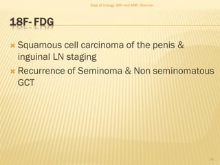 18F- FDG
 Squamous cell carcinoma of the penis &
inguinal LN staging
 Recurrence of Seminoma & Non seminomatous
GCT
45
Dept of Urology, GRH and KMC, Chennai.
 