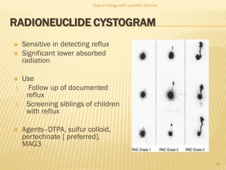 RADIONEUCLIDE CYSTOGRAM
 Sensitive in detecting reflux
 Significant lower absorbed
radiation
 Use
1. Follow up of documented
reflux
2. Screening siblings of children
with reflux
 Agents–DTPA, sulfur colloid,
pertechnate [ preferred],
MAG3
48
Dept of Urology, GRH and KMC, Chennai.
 
