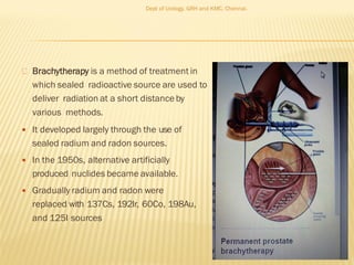 Brachytherapy is a method of treatment in
which sealed radioactive source are used to
deliver radiation at a short distance by
various methods.
 It developed largely through the use of
sealed radium and radon sources.
 In the 1950s, alternative artificially
produced nuclides became available.
 Gradually radium and radon were
replaced with 137Cs, 192Ir, 60Co, 198Au,
and 125I sources
51
Dept of Urology, GRH and KMC, Chennai.
 