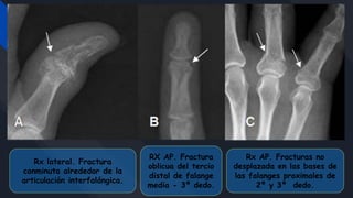 Radiología en fisioterapia | PPTX