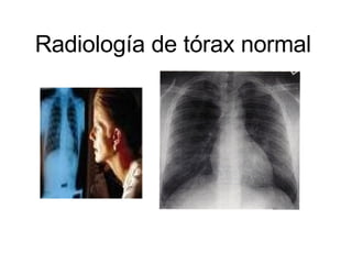 Radiología de tórax normal 