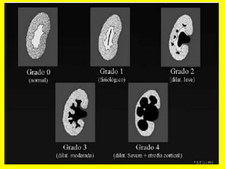 Radiología urológica