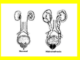 Radiología urológica