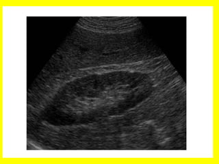 Radiología urológica
