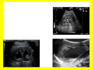 Radiología urológica