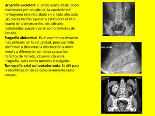 Urografía excretora. Cuando existe obstrucción
ocasionada por un cálculo, la aparición del
nefrograma está retardado en el lado afectado.
Las placas tardías ayudan a establecer el sitio
exacto de la obstrucción. Los cálculos
radiolúcidos pueden verse como defectos de
llenado.
Ecografía abdominal. Es el examen no invasivo
más utilizado en la actualidad, pues permite
confirmar o descartar la obstrucción a nivel
renal y a diferenciar con otras causas los
defectos de llenado, observando en la
urografía, tales como tumores o coágulos.
Tomografía axial computadorizada. Es útil para
la identificación de cálculos levemente radio-
opacos.
 
