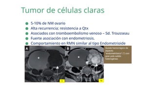 Radiología CA OVARIO [Autoguardado].pptx