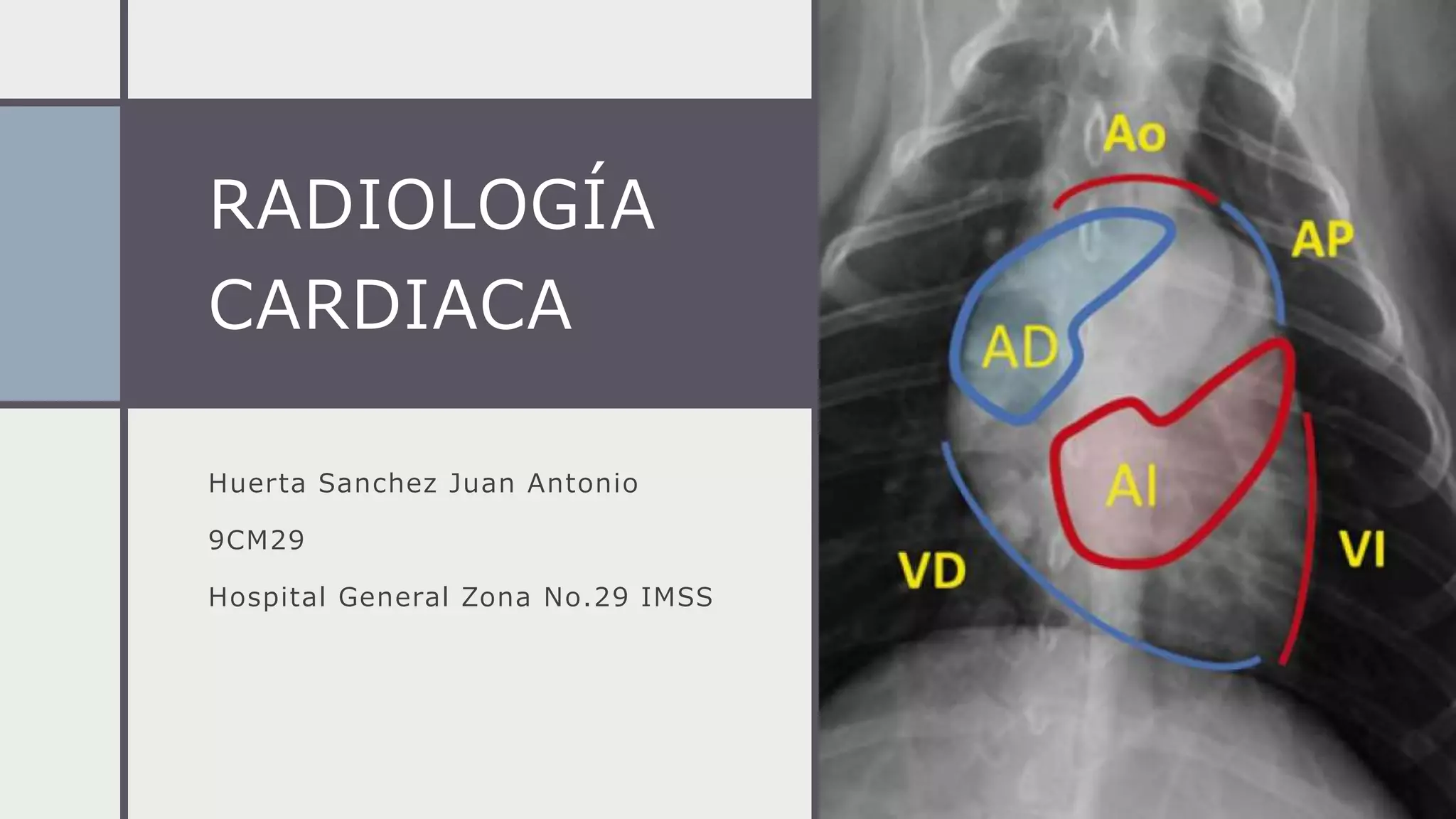 Radiología cardiaca.pptx