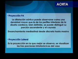 AORTA Proyección PA La dilatación aórtica puede observarse como una densidad mayor que la de los perfiles inferiores de la silueta cardiaca, bien definida, se puede distinguir su porción ascendente y el cayado Ensanchamiento mediastinal desde discreto hasta masivo Proyección Lateral Es la proyección en la que mejor se observa, se visualizan las tres porciones intratorácicas del vaso 