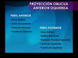 PROYECCIÓN OBLICUA ANTERIOR IZQUIERDA PERFIL ANTERIOR Arco Aórtico Aorta Ascendente Orejuela Derecha  Ventrículo Derecho PERFIL POSTERIOR Arco Aórtico  Arteria Pulmonar  Bronquio Principal Izquierdo Aurícula Izquierda Ventrículo Izquierdo 