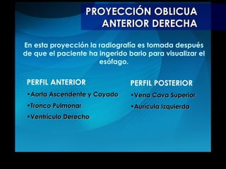 PROYECCIÓN OBLICUA ANTERIOR DERECHA PERFIL ANTERIOR Aorta Ascendente y Cayado Tronco Pulmonar  Ventrículo Derecho   PERFIL POSTERIOR Vena Cava Superior Aurícula Izquierda En esta proyección la radiografía es tomada después de que el paciente ha ingerido bario para visualizar el esófago. 