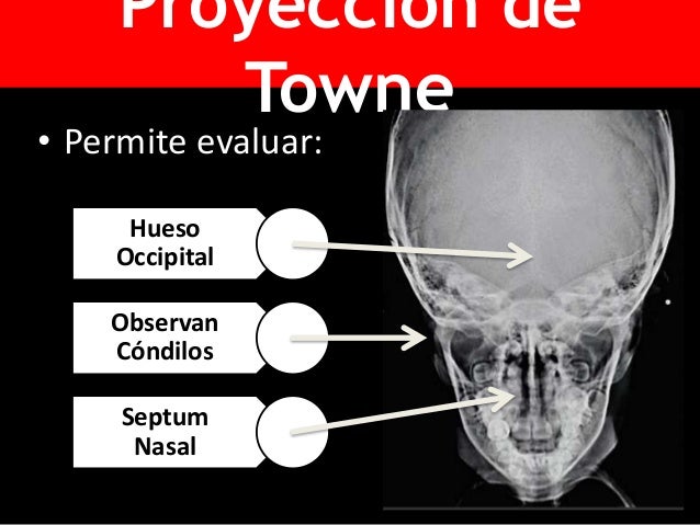 Radiología de craneo fernanda pineda gea - unica 2016.