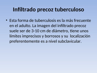 Infiltrado precoz tuberculoso
• Esta forma de tuberculosis es la más frecuente
en el adulto. La imagen del infiltrado precoz
suele ser de 3-10 cm de diámetro, tiene unos
límites imprecisos y borrosos y su localización
preferentemente es a nivel subclavicular.
 