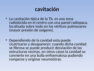 cavitación
• La cavitación típica de la Tb. es una zona
radiolúcida en el centro con una pared radiopaca,
localizada sobre todo en los vértices pulmonares
(mayor presión de oxígeno).
• Dependiendo de la cavidad esta puede
cicatrizarse y desaparecer; cuando dicha cavidad
se fibrosa se puede producir desviación de las
estructuras vecinas, en otros casos la cavidad se
convierte en una bulla enfisematosa pudiendo
romperse y originar neumotórax.
 