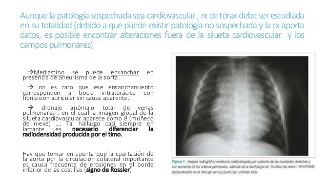 Radiología del corazón