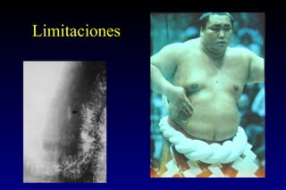 Limitaciones 