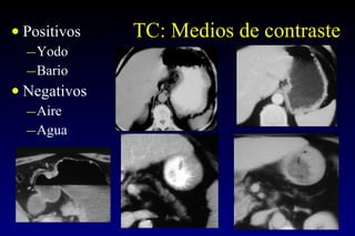 TC: Medios de contraste Positivos Yodo Bario Negativos Aire Agua 