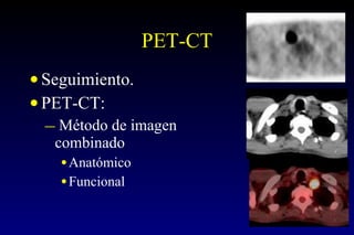 PET-CT Seguimiento. PET-CT: Método de imagen combinado Anatómico Funcional 