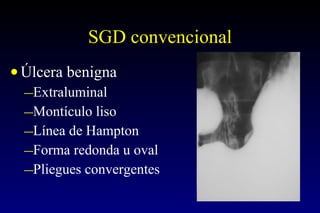 SGD convencional Úlcera benigna Extraluminal Montículo liso Línea de Hampton Forma redonda u oval Pliegues convergentes 