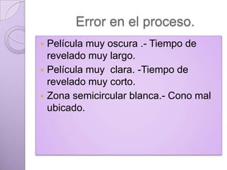 Error en el proceso.
Película muy oscura .- Tiempo de
revelado muy largo.
 Película muy clara. -Tiempo de
revelado muy corto.
 Zona semicircular blanca.- Cono mal
ubicado.


 