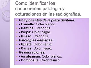 Como identificar los
conponentes,patologia y
obturaciones en las radiografías.












Componentes de la pieza dentaria:
- Esmalte: Color blanco.
- Dentina: Color gris.
- Pulpa: Color negro.
- Hueso: Color gris.
Patologías dentarias:
- Quisté: Color negro.
- Caries: Color negro.
Restauraciones:
- Amalgamas: Color blanco.
- Composite: Color blanco.

 