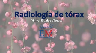 Radiología de tórax 
Yiniver Elizalde Vázquez 
 