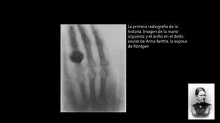 Radiología odontológica contemporánea Tema 1: Historia de la Radiología ...