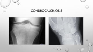 Radiología osteoarticular no traumática. | PDF