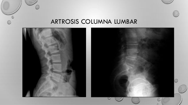 Radiología osteoarticular no traumática.