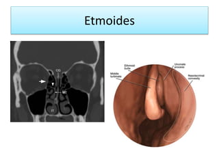 Etmoides
 