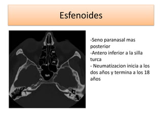Esfenoides
-Seno paranasal mas
posterior
-Antero inferior a la silla
turca
- Neumatizacion inicia a los
dos años y termina a los 18
años
 