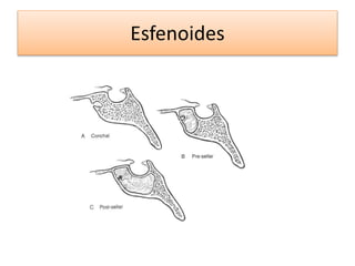 Esfenoides
 