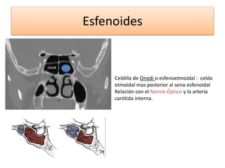 Esfenoides
Celdilla de Onodi o esfenoetmoidal : celda
etmoidal mas posterior al seno esfenoidal
Relación con el Nervio Óptico y la arteria
carótida interna.
 