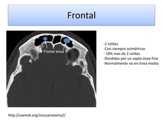 Frontal
http://uwmsk.org/sinusanatomy2/
-2 celdas
-Casi siempre asimétricas
- 10% mas de 2 celdas
-Divididas por un septo óseo fino
-Normalmente no en línea media
 