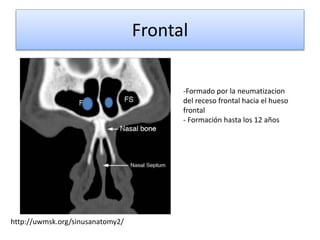 Frontal
http://uwmsk.org/sinusanatomy2/
-Formado por la neumatizacion
del receso frontal hacia el hueso
frontal
- Formación hasta los 12 años
 