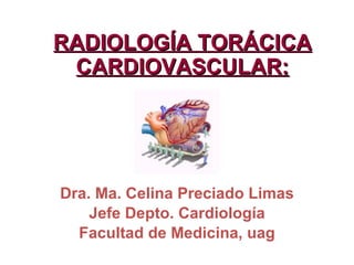 RADIOLOGÍA TORÁCICA CARDIOVASCULAR: Dra. Ma. Celina Preciado Limas Jefe Depto. Cardiología Facultad de Medicina, uag 