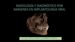 RADIOLOGÍA Y DIAGNÓSTICO POR
IMÁGENES EN IMPLANTOLOGIA ORAL
C.D. Esp.: JHYNA SINDY GUTIÉRREZ APARCO
 