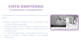 O tratamento do cisto dentígero depende do tamanho da
lesão.
Lesões pequenas: tratadas por enucleação com
remoção do dente associado.
Lesões grandes: podem requerer marsupialização ou
drenagem cirúrgica, para reduzir o tamanho do cisto e
preservar o osso.
A marsupialização tem a vantagem de preservar o
dente envolvido e pode permitir sua erupção
espontânea.
CISTO DENTÍGERO
Tratamento e prognóstico
 