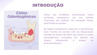 INTRODUÇÃO
Cistos são entidades classificadas como
cavidades patológicas, em sua maioria
revestidas por epitélio, de conteúdo fluido,
semi-fluido ou gasoso.
Na região maxilofacial, seguimos a classificação
mais recente de acordo com da Organização
Mundial da Saúde (de 2017), que divide os cistos
odontogênicos revestidos por epitélio em
origem inflamatória e origem no
desenvolvimento.
 