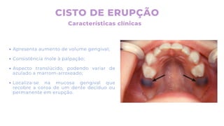 CISTO DE ERUPÇÃO
Características clínicas
Apresenta aumento de volume gengival;
Consistência mole à palpação;
Aspecto translúcido, podendo variar de
azulado a marrom-arroxeado;
Localiza-se na mucosa gengival que
recobre a coroa de um dente decíduo ou
permanente em erupção.
 