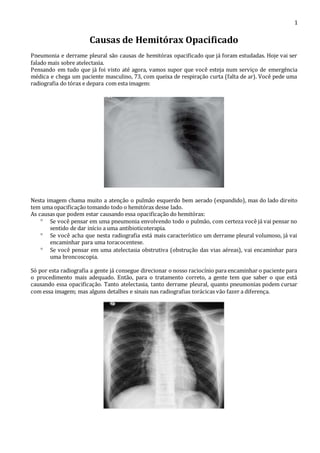 1 
Causas de Hemitórax Opacificado 
Pneumonia e derrame pleural são causas de hemitórax opacificado que já foram estudadas. Hoje vai ser 
falado mais sobre atelectasia. 
Pensando em tudo que já foi visto até agora, vamos supor que você esteja num serviço de emergência 
médica e chega um paciente masculino, 73, com queixa de respiração curta (falta de ar). Você pede uma 
radiografia do tórax e depara com esta imagem: 
Nesta imagem chama muito a atenção o pulmão esquerdo bem aerado (expandido), mas do lado direito 
tem uma opacificação tomando todo o hemitórax desse lado. 
As causas que podem estar causando essa opacificação do hemitórax: 
 Se você pensar em uma pneumonia envolvendo todo o pulmão, com certeza você já vai pensar no 
sentido de dar início a uma antibioticoterapia. 
 Se você acha que nesta radiografia está mais característico um derrame pleural volumoso, já vai 
encaminhar para uma toracocentese. 
 Se você pensar em uma atelectasia obstrutiva (obstrução das vias aéreas), vai encaminhar para 
uma broncoscopia. 
Só por esta radiografia a gente já consegue direcionar o nosso raciocínio para encaminhar o paciente para 
o procedimento mais adequado. Então, para o tratamento correto, a gente tem que saber o que está 
causando essa opacificação. Tanto atelectasia, tanto derrame pleural, quanto pneumonias podem cursar 
com essa imagem; mas alguns detalhes e sinais nas radiografias torácicas vão fazer a diferença. 
 