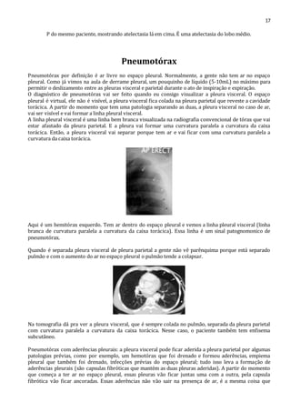 17 
P do mesmo paciente, mostrando atelectasia lá em cima. É uma atelectasia do lobo médio. 
Pneumotórax 
Pneumotórax por definição é ar livre no espaço pleural. Normalmente, a gente não tem ar no espaço 
pleural. Como já vimos na aula de derrame pleural, um pouquinho de líquido (5-10mL) no máximo para 
permitir o deslizamento entre as pleuras visceral e parietal durante o ato de inspiração e expiração. 
O diagnóstico de pneumotórax vai ser feito quando eu consigo visualizar a pleura visceral. O espaço 
pleural é virtual, ele não é visível, a pleura visceral fica colada na pleura parietal que reveste a cavidade 
torácica. A partir do momento que tem uma patologia separando as duas, a pleura visceral no caso de ar, 
vai ser visível e vai formar a linha pleural visceral. 
A linha pleural visceral é uma linha bem branca visualizada na radiografia convencional de tórax que vai 
estar afastado da pleura parietal. E a pleura vai formar uma curvatura paralela a curvatura da caixa 
torácica. Então, a pleura visceral vai separar porque tem ar e vai ficar com uma curvatura paralela a 
curvatura da caixa torácica. 
Aqui é um hemitórax esquerdo. Tem ar dentro do espaço pleural e vemos a linha pleural visceral (linha 
branca de curvatura paralela a curvatura da caixa torácica). Essa linha é um sinal patognomonico de 
pneumotórax. 
Quando é separada pleura visceral de pleura parietal a gente não vê parênquima porque está separado 
pulmão e com o aumento do ar no espaço pleural o pulmão tende a colapsar. 
Na tomografia dá pra ver a pleura visceral, que é sempre colada no pulmão, separada da pleura parietal 
com curvatura paralela a curvatura da caixa torácica. Nesse caso, o paciente também tem enfisema 
subcutâneo. 
Pneumotórax com aderências pleurais: a pleura visceral pode ficar aderida a pleura parietal por algumas 
patologias prévias, como por exemplo, um hemotórax que foi drenado e formou aderências, empiema 
pleural que também foi drenado, infecções prévias do espaço pleural; tudo isso leva a formação de 
aderências pleurais (são capsulas fibróticas que mantém as duas pleuras aderidas). A partir do momento 
que começa a ter ar no espaço pleural, essas pleuras vão ficar juntas uma com a outra, pela capsula 
fibrótica vão ficar ancoradas. Essas aderências não vão sair na presença de ar, é a mesma coisa que 
 